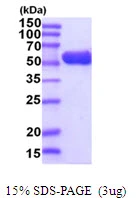 3?g glpK protein (GTX57492-pro) by SDS-PAGE under reducing condition and visualized by coomassie blue stain.