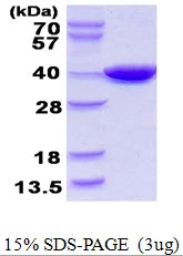 3?g CoaA protein (GTX57494-pro) by SDS-PAGE under reducing condition and visualized by coomassie blue stain.