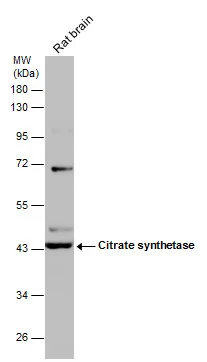 Citrate synthetase antibody [GT2061] detects Citrate synthetase protein at mitochondria by immunofluorescent analysis.