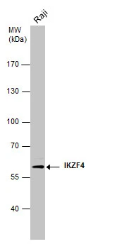 Whole cell extract (30 ug) was separated by 7.5% SDS-PAGE,and the membrane was blotted with IKZF4 antibody [GT976] (GTX629811) diluted at 1:1000.