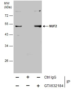 Immunoprecipitation of NUF2 protein from HeLa whole cell extracts using 5 ug of NUF2 antibody [GT644] (GTX632184) .Western blot analysis was performed using NUF2 antibody [GT644] (GTX632184).