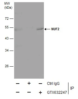 Immunoprecipitation of NUF2 protein from HeLa whole cell extracts using 5 ug of NUF2 antibody [GT312] (GTX632247) .Western blot analysis was performed using NUF2 antibody [GT312] (GTX632247).