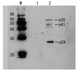 Detection of HIV-1 p24 and precursor proteins p55 and p41 by Western blotting using the anti p24 antibody (unconjugated)).