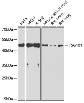 IHC-P analysis of human liver injury tissue using GTX64349 TSG101 antibody. Dilution : 1:100