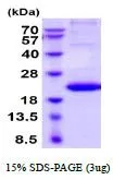 3 ?g of GTX67170-pro Human TNF beta protein (active) by SDS-PAGE under reducing condition and visualized by coomassie blue stain