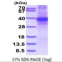 3?g Human SPRY4 protein (GTX68773-pro) by SDS-PAGE under reducing condition and visualized by coomassie blue stain.