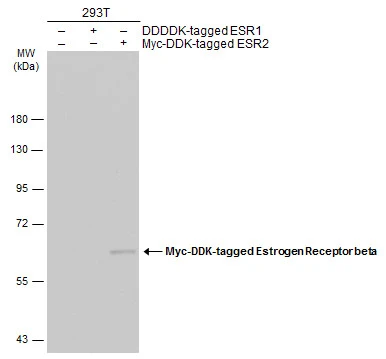 Non-transfected (�) and transfected (+) 293T whole cell extracts (30 ug) were separated by 7.5% SDS-PAGE,and the membrane was blotted with Estrogen Receptor beta antibody [7B10.7] (GTX70182) diluted at 1:1000.