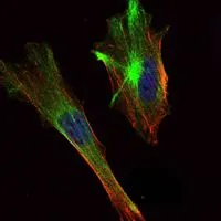 ICC/IF analysis of HeLa cells using GTX82754 TORC2 antibody [5B10]. Green : TORC2 Blue: DRAQ5 fluorescent DNA dye Red: Actin filaments