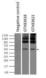 ICC/IF analysis of COS7 cells transiently transfected with SLC7A8 plasmid using GTX83618 SLC7A8 antibody [5A9].