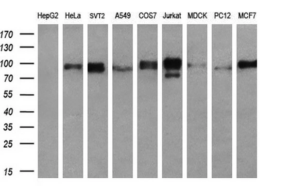 WB analysis of various cell lines using GTX83727 RALBP1 antibody [1H9]. Loading : 35 ug per lane Dilution : 1:200