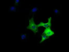 WB analysis of HEK293T cells transfected with DYNC1LI1 plasmid (Right) or empty vector (Left) for 48 hrs using GTX84596 DYNC1LI1 antibody [1B9]. Loading : 5 ug per lane