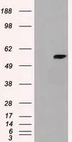 WB analysis of various cell lines using GTX84633 Cyp7b1 antibody [7H10]. Loading : 35 ug per lane Dilution : 1:200