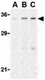 WB analysis of rat brain tissue lysate using GTX85503 CTRP4 antibody. Working concentration : (A) 1,(B) 2,and (C) 4 ug/ml