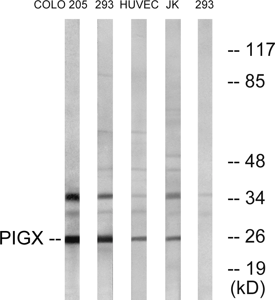 WB analysis of 293,COLO,HUVEC,and Jurkat cell lysates using GTX87371 PIGX antibody. The lane on the right is blocked with the synthesized peptide.