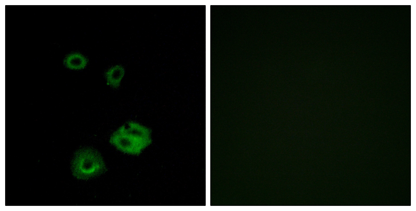 ICC/IF analysis of A549 cells using GTX87927 NPY2R antibody. The picture on the right is blocked with the synthesized peptide.