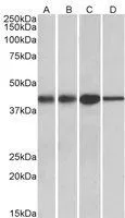 WB analysis of human liver lysate using GTX88076 ACAT1 (aa257-269) antibody,Internal. Dilution : 0.01ug/ml Loading : 35ug protein in RIPA buffer