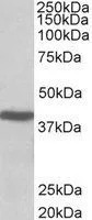 WB analysis of mouse liver lysate using GTX88247 ACAT1 (aa253-266) antibody,Internal. Dilution : 0.01ug/ml Loading : 35ug protein in RIPA buffer