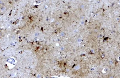 IHC-P analysis of human brain cortex using GTX88496 Ferritin Light Chain antibody,C-term. Antigen retrieval : citrate buffer pH 6 Dilution : 3.8ug/ml