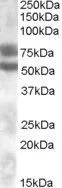 WB analysis of human kidney lysate using GTX88629 DACH1 antibody,Internal. Dilution : 0.1ug/ml Loading : 35ug protein in RIPA buffer