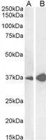 WB analysis of mouse liver (A) and rat liver (B) lysates using GTX89099 Arginase 1 antibody,C-term. Dilution : 0.05ug/ml Loading : 35ug protein in RIPA buffer