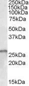 WB analysis of human cerebellum lysate using GTX89136 SMN1 / SMN2 antibody,Internal. Dilution : 1ug/ml Loading : 35ug protein in RIPA buffer