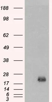 WB analysis of mouse brain lysate using GTX89453 BAALC antibody,Internal. Dilution : 0.03ug/ml Loading : 35ug protein in RIPA buffer