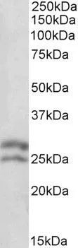 WB analysis of human lymph lysate using GTX89719 Bcl-2 antibody,N-term. Dilution : 0.1ug/ml Loading : 35ug protein in RIPA buffer