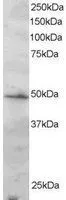 WB analysis of Jurkat lysate using GTX89898 IRF2 antibody,C-term. Dilution : 2ug/ml Loading : 30ug protein in RIPA buffer