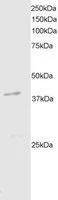 IHC-P analysis of human breast using GTX89970 DAP Kinase 2 antibody,C-term. Antigen retrieval : citrate buffer pH 6 Dilution : 2.5ug/ml