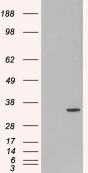WB analysis of HEK293 overexpressing ORC6 (mock transfection in first lane) using GTX89996 ORC6 antibody,C-term.