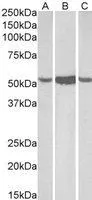 WB analysis of human (A),mouse (B) and rat (C) liver lysate using GTX90658 ALDH1A1 antibody,C-term. Dilution : 0.1ug/ml Loading : 35ug protein in RIPA buffer