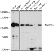 Anti-AMOTL1 antibody used in Western Blot (WB). GTX00660