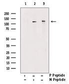 Anti-PERK (phospho Ser555) antibody used in Western Blot (WB). GTX00673