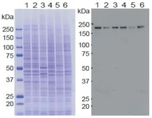 Anti-KDM5A / Jarid1A / RBBP2 antibody [18E8] used in Western Blot (WB). GTX00688