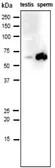 Anti-IZUMO1 antibody [#125] used in Western Blot (WB). GTX00689
