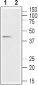 Anti-GPR43 antibody used in Western Blot (WB). GTX00816