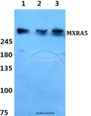 Anti-MXRA5 antibody used in Western Blot (WB). GTX00827