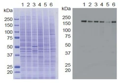 Anti-KDM5A / Jarid1A / RBBP2 antibody [9A6] used in Western Blot (WB). GTX01204