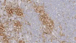 Anti-CD33 antibody [PWS44] used in IHC (Paraffin sections) (IHC-P). GTX01852