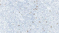 Anti-NCAM antibody [CD564] used in IHC (Paraffin sections) (IHC-P). GTX01917