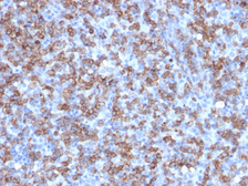 Anti-CD8 alpha antibody [C8/1779R] used in IHC (Paraffin sections) (IHC-P). GTX02617