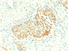 Anti-NCAM antibody [NCAM1/2217R] used in IHC (Paraffin sections) (IHC-P). GTX02686