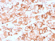 Anti-Prolactin Receptor antibody [rPRLR/742] used in IHC (Paraffin sections) (IHC-P). GTX02693