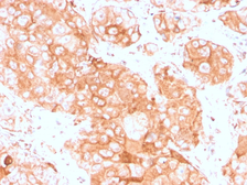 Anti-Prolactin Receptor antibody [PRLR/3785R] used in IHC (Paraffin sections) (IHC-P). GTX02694