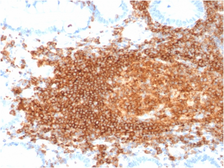 Anti-CD45RB antibody [rPTPRC/1132] used in IHC (Paraffin sections) (IHC-P). GTX02699