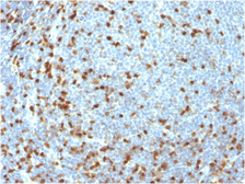 Anti-ZAP70 antibody [ZAP70/3921R] used in IHC (Paraffin sections) (IHC-P). GTX02745