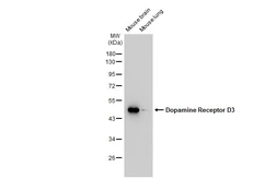 Anti-Dopamine Receptor D3 antibody [GT1239] used in Western Blot (WB). GTX02836