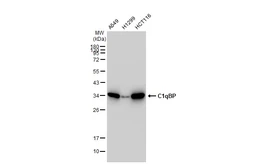 Anti-C1qBP antibody [GT1250] used in Western Blot (WB). GTX02847