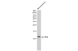 Anti-PF4 antibody [GT1260] used in Western Blot (WB). GTX02857