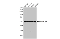 Anti-mAChR M2 antibody [GT1272] used in Western Blot (WB). GTX03184